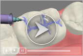 3D Dental Patient Education Icon