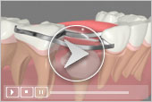 3D Dental Patient Education Icon